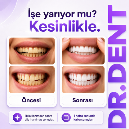 2. Nesil Diş Beyazlatma Şeritleri